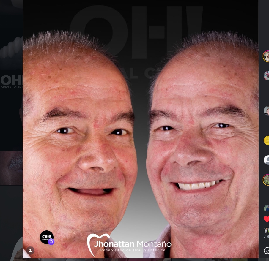 Rehabilitación Oral Completa